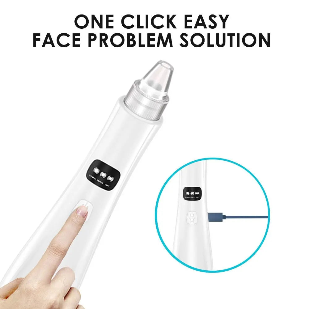 3-Mode Facial Pore Vacuum – Blackhead & Dead Skin Remover