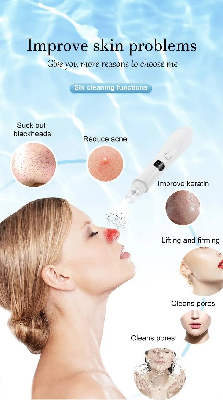 3-Mode Facial Pore Vacuum – Blackhead & Dead Skin Remover