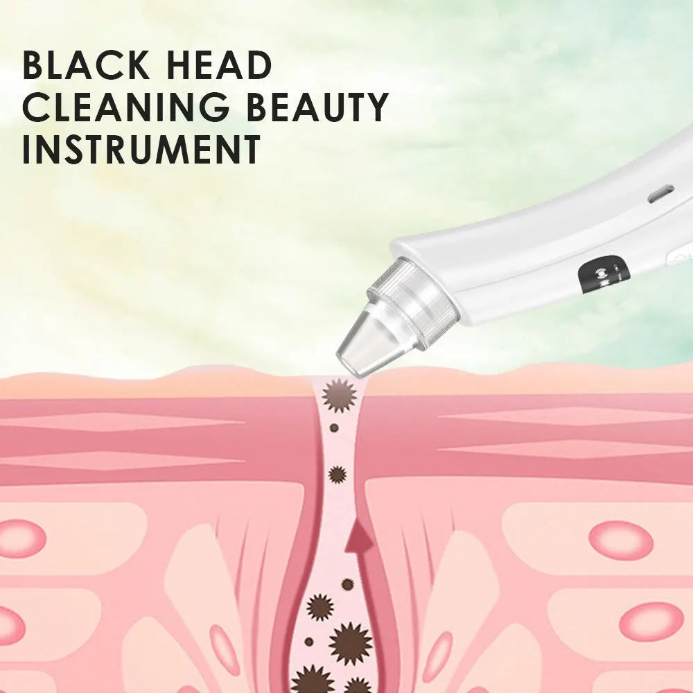 3-Mode Facial Pore Vacuum – Blackhead & Dead Skin Remover